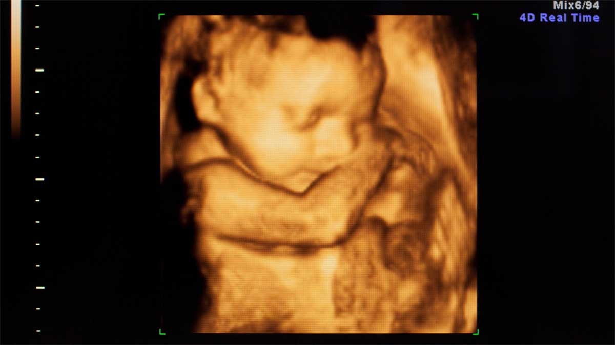 Recommended 2D, 3D & 4D Pregnancy Scans